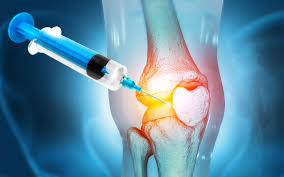 Regenerative orthopedic