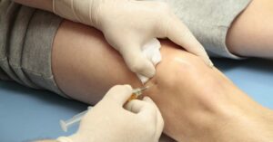 PRP Shot for Runners